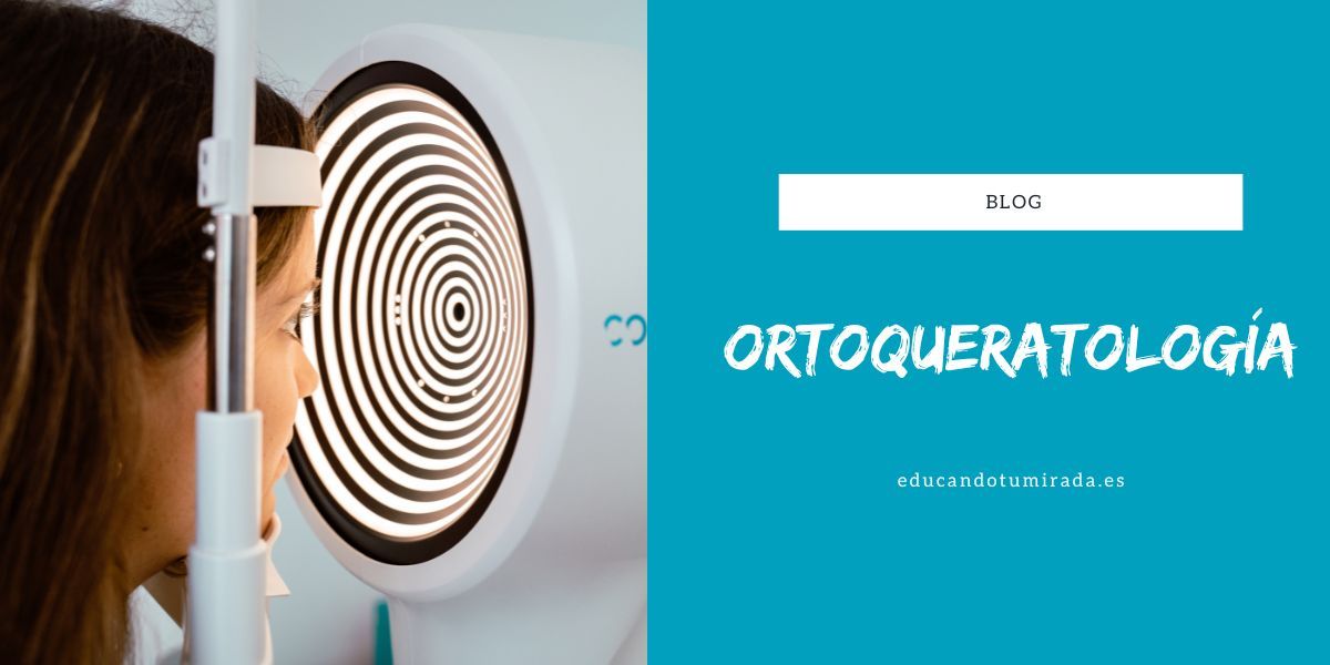 Ortoqueratología | Educando tu mirada