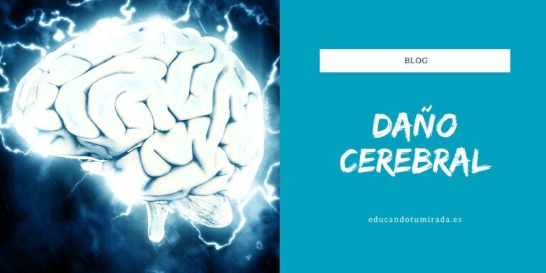 Daño Cerebral | Educando tu mirada