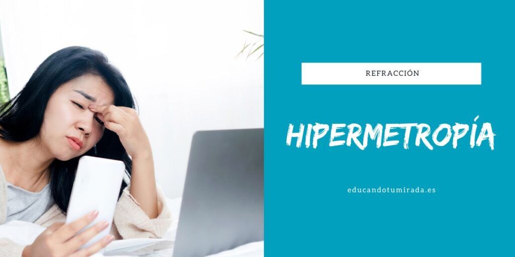 Hipermetropía | Educando tu mirada