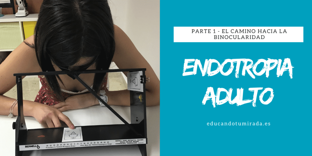 Endotropia Adulto | en Educando tu mirada