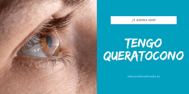 Tengo Queratocono | ¿Y ahora qué? | Blog | en Educando tu mirada