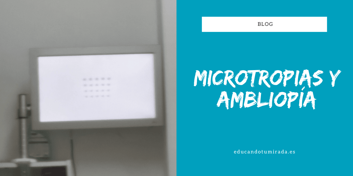 Microtropias y Ambliopía | Blog | en Educando tu mirada | Valencia