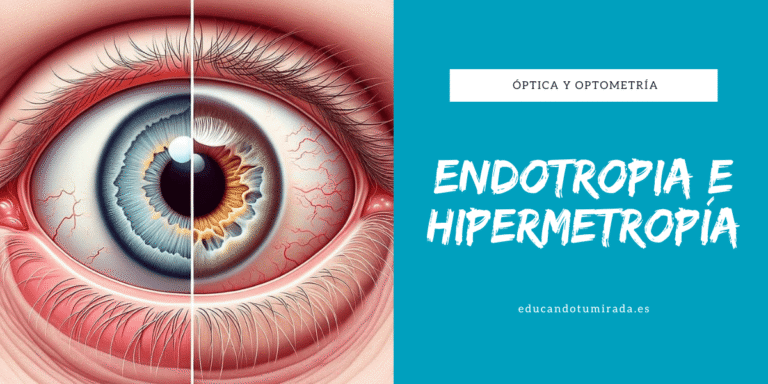 Endotropia e hipermetropía | Blog | en Educando tu mirada